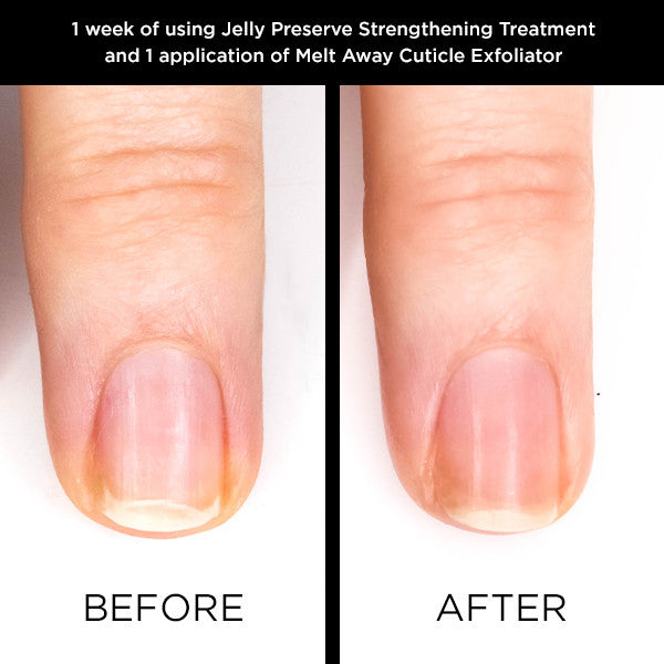 Jelly Preserve Strengthening Treatment